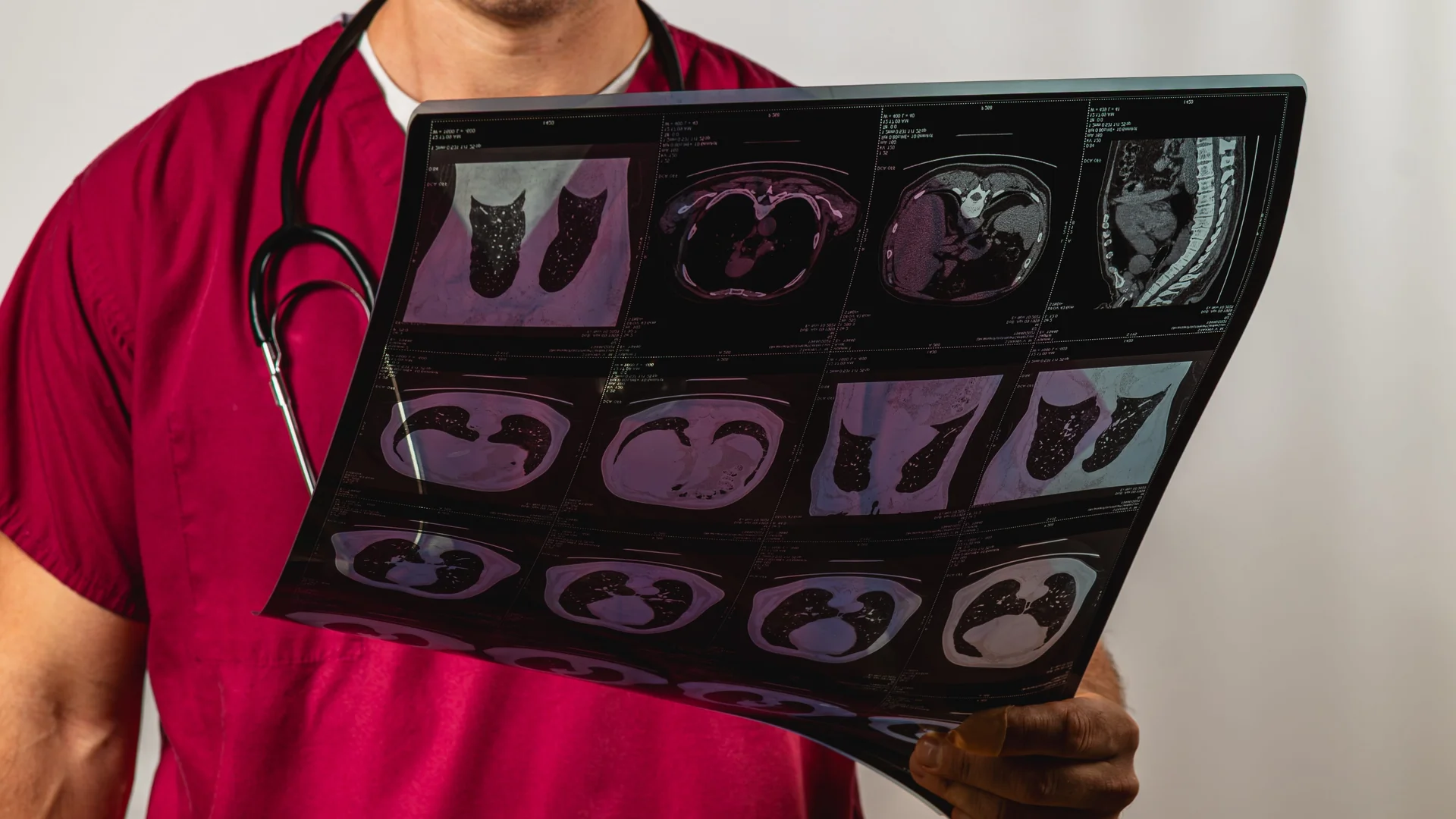 In the Loop, On the Loop, Off the Loop: Radiology's Next Decade of Agents and Oversight